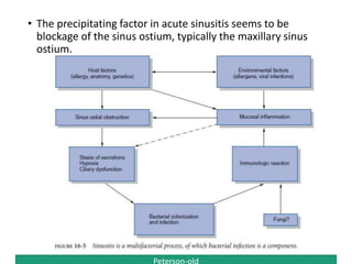 Peterson-old
• The precipitating factor in acute sinusitis seems to be
blockage of the sinus ostium, typically the maxillary sinus
ostium.
 