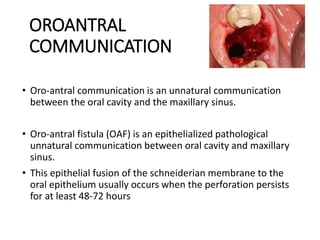 OROANTRAL
COMMUNICATION
• Oro-antral communication is an unnatural communication
between the oral cavity and the maxillary sinus.
• Oro-antral fistula (OAF) is an epithelialized pathological
unnatural communication between oral cavity and maxillary
sinus.
• This epithelial fusion of the schneiderian membrane to the
oral epithelium usually occurs when the perforation persists
for at least 48-72 hours
 