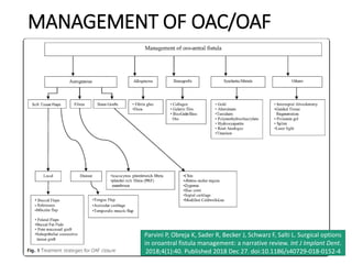 MANAGEMENT OF OAC/OAF
Parvini P, Obreja K, Sader R, Becker J, Schwarz F, Salti L. Surgical options
in oroantral fistula management: a narrative review. Int J Implant Dent.
2018;4(1):40. Published 2018 Dec 27. doi:10.1186/s40729-018-0152-4
 