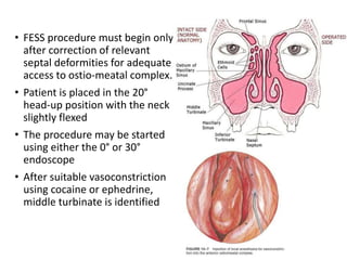 • FESS procedure must begin only
after correction of relevant
septal deformities for adequate
access to ostio-meatal complex.
• Patient is placed in the 20°
head-up position with the neck
slightly flexed
• The procedure may be started
using either the 0° or 30°
endoscope
• After suitable vasoconstriction
using cocaine or ephedrine,
middle turbinate is identified
 