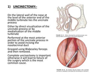 1) UNCINECTOMY:-
On the lateral wall of the nose at
the level of the anterior end of the
middle turbinate lies the uncinate
process
Either by direct visualisation of the
uncinate process or by
medialisation of the middle
turbinate
Performed at the most anterior
portion of the uncinate process in
order to avoid incising the
nasolacrimal duct
Grasped using Blakeseley forceps
and then removed.
Complete uncinectomy is important
otherwise it will lead to failure of
the surgery which is the most
common cause.
 