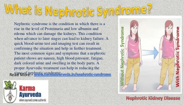 Ayurvedic Medicine For Nephrotic Syndrome Diet Chart For Nephrotic S