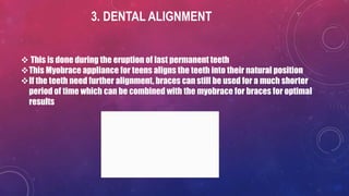 3. DENTAL ALIGNMENT
 This is done during the eruption of last permanent teeth
This Myobrace appliance for teens aligns the teeth into their natural position
If the teeth need further alignment, braces can still be used for a much shorter
period of time which can be combined with the myobrace for braces for optimal
results
 