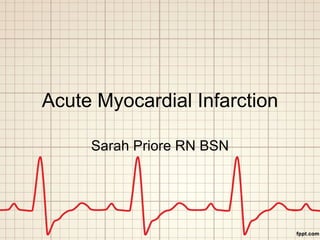 Acute Myocardial Infarction Sarah Priore RN BSN 