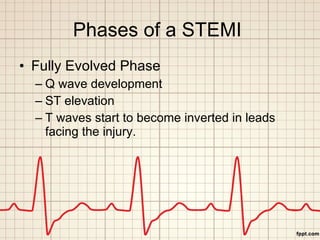 Phases of a STEMI  <ul><li>Fully Evolved Phase </li></ul><ul><ul><li>Q wave development </li></ul></ul><ul><ul><li>ST elev...