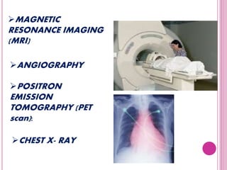 MAGNETIC
RESONANCE IMAGING
(MRI)
CHEST X- RAY
ANGIOGRAPHY
POSITRON
EMISSION
TOMOGRAPHY (PET
scan):
 