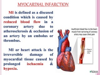 MYOCARDIAL INFARCTION
MI is defined as a diseased
condition which is caused by
reduced blood flow in a
coronary artery due to
atherosclerosis & occlusion of
an artery by an embolus or
thrombus.
MI or heart attack is the
irreversible damage of
myocardial tissue caused by
prolonged ischaemia &
hypoxia.
 