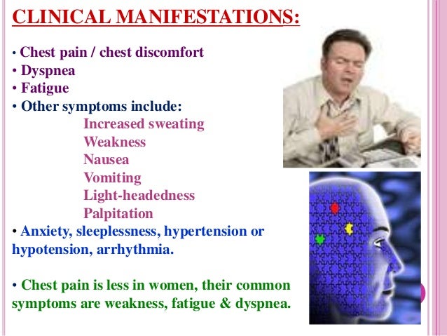 Myocardial Infarction