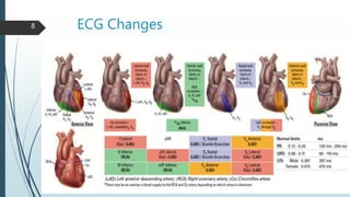 ECG Changes8
 
