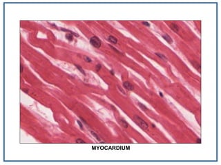 MYOCARDIUM
 