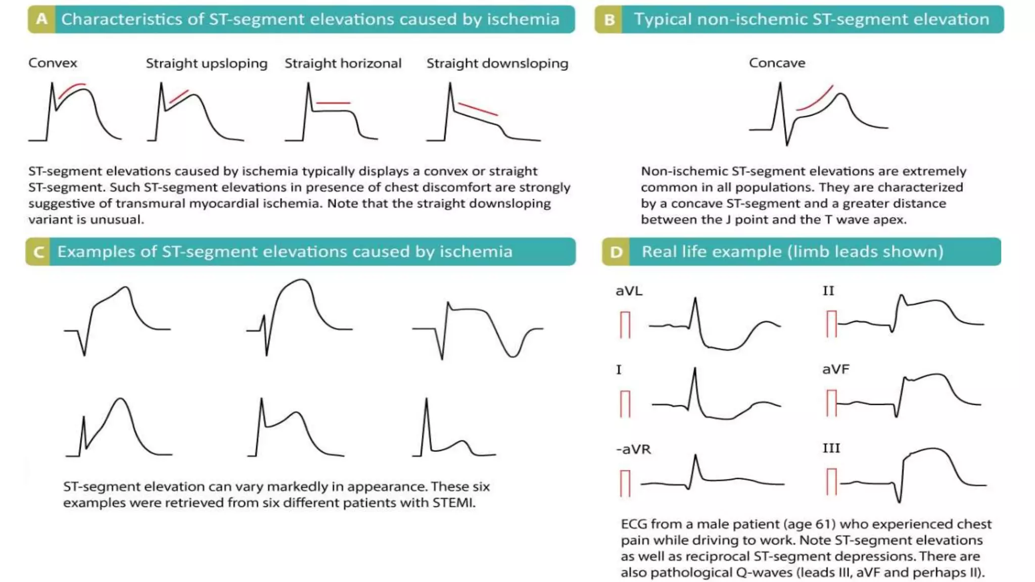MyoCardioPress main image 0