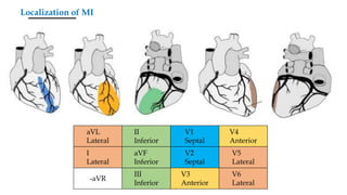Myocardial infarction - https://medicalbooksvn.wordpress.com/ | PPTX