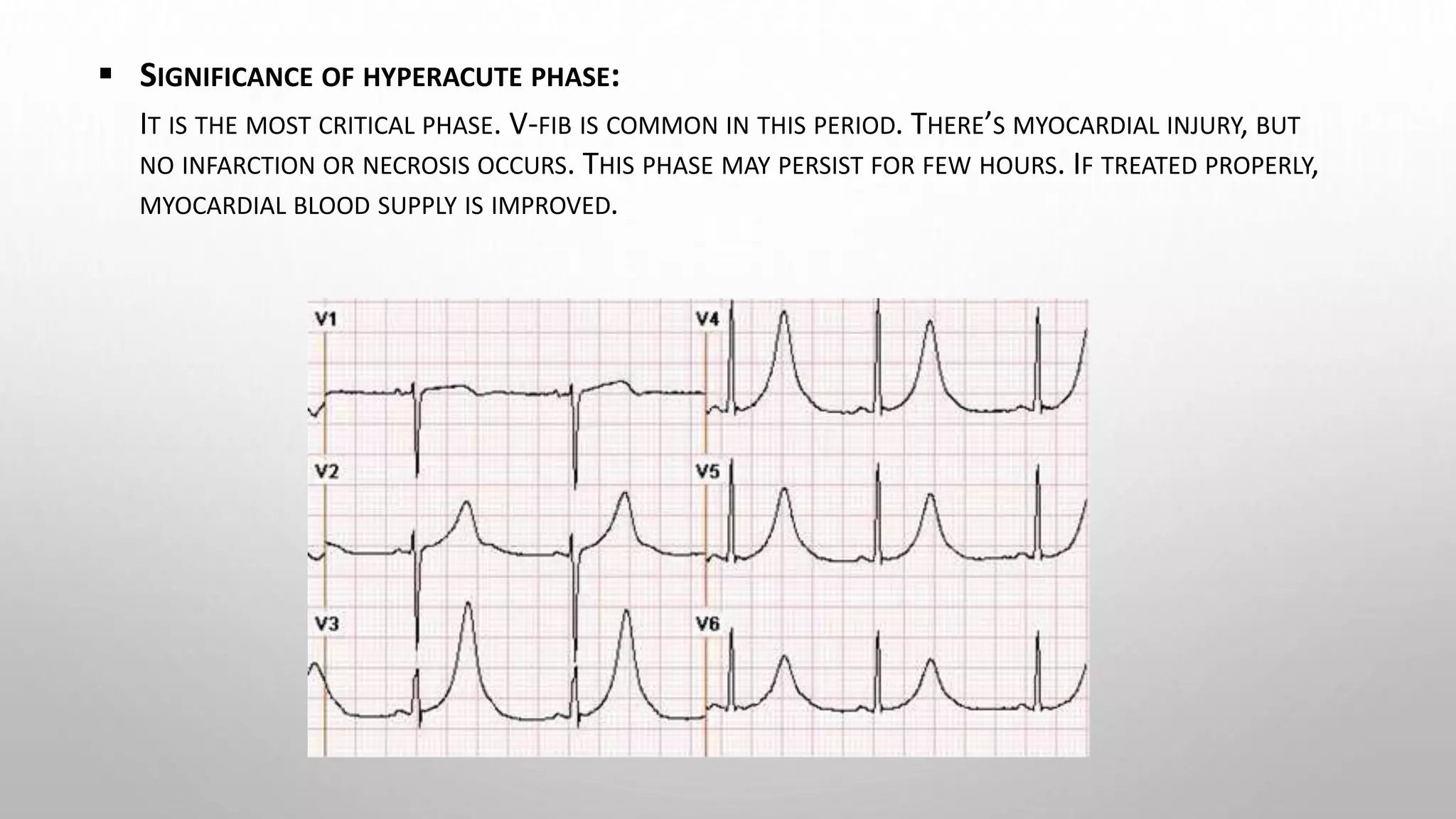 Myocardial infarction: introduction, clinical manifestation ...