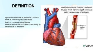 Myocardial infarction is a disease condition
which is caused by reduced blood
flow in a coronary artery due to
atherosclerosis and occlusion of an artery by
an embolus or thrombus
DEFINITION
 