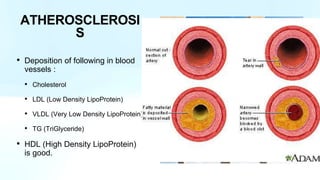 • Deposition of following in blood
vessels :
• Cholesterol
• LDL (Low Density LipoProtein)
• VLDL (Very Low Density LipoProtein)
• TG (TriGlyceride)
• HDL (High Density LipoProtein)
is good.
ATHEROSCLEROSI
S
 