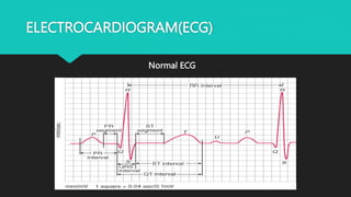 ELECTROCARDIOGRAM(ECG)
Normal ECG
 