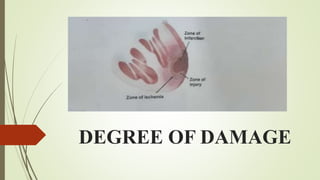 DEGREE OF DAMAGE
 