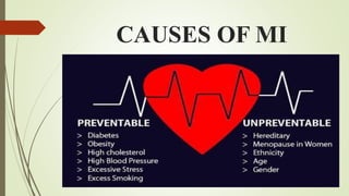 CAUSES OF MI
 