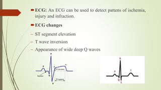 ECG: An ECG can be used to detect pattens of ischemia,
injury and infraction.
ECG changes
 ST segment elevation
 T wave inversion
 Appearance of wide deep Q waves
 