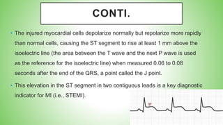 SEMINAR ON Myocardial infarction FOR NURSING STUDENT.pptx