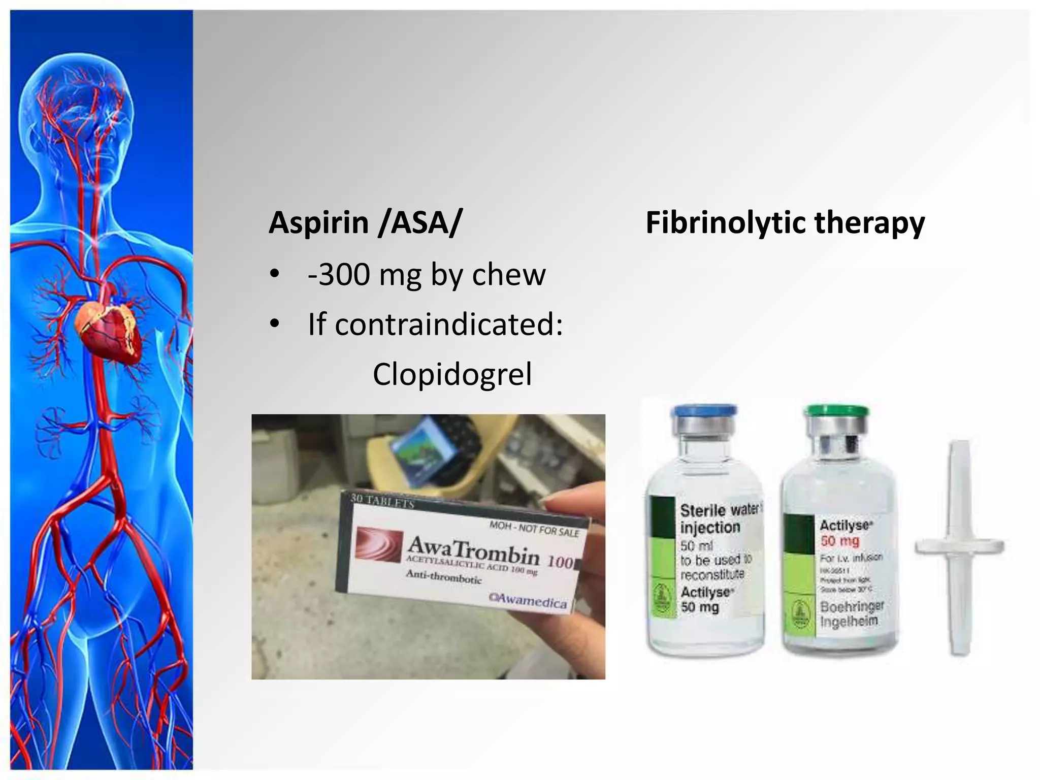 Aspirin /ASA/
• -300 mg by chew
• If contraindicated:
Clopidogrel
Fibrinolytic therapy
 