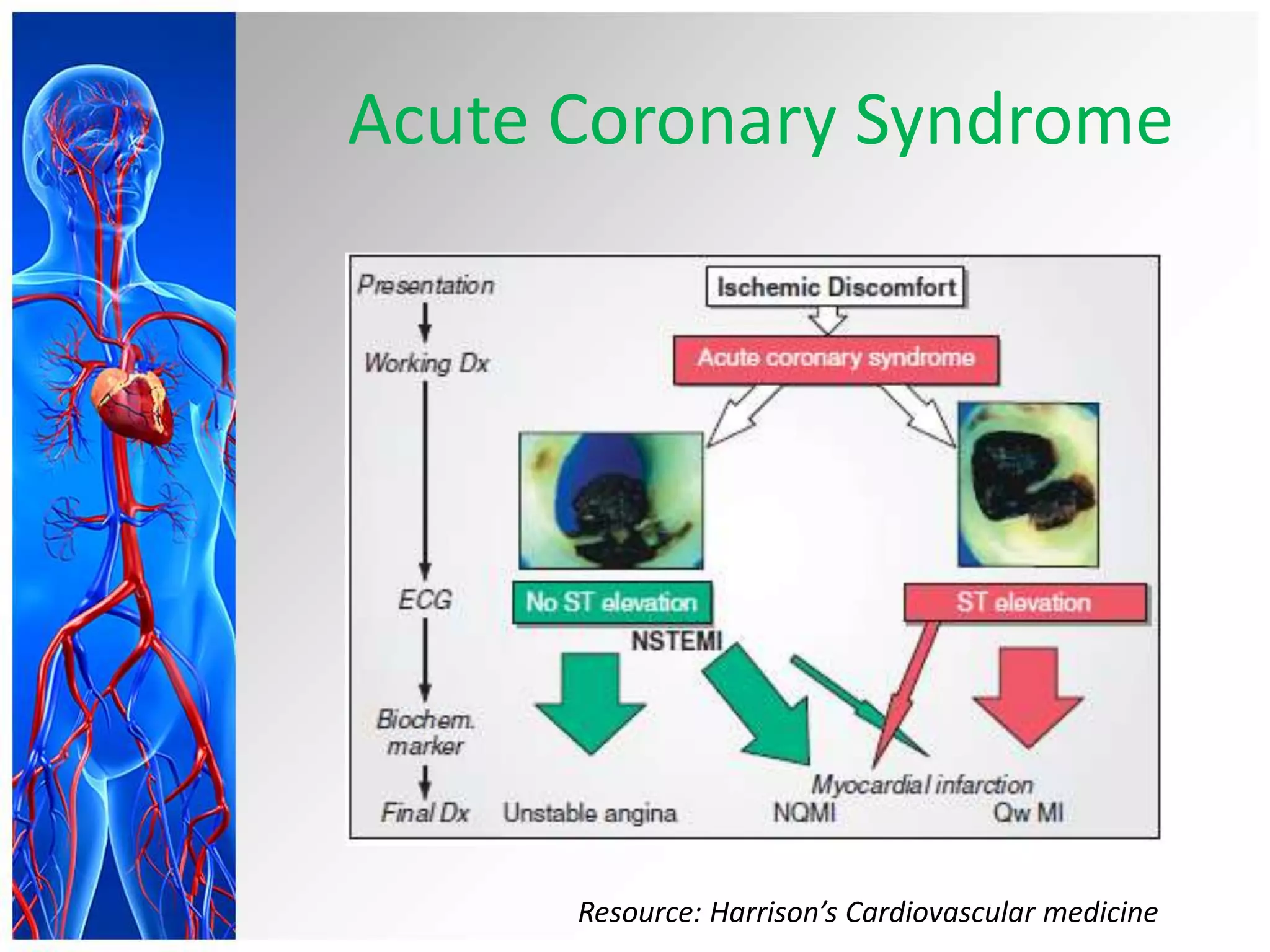 Acute Coronary Syndrome
Resource: Harrison’s Cardiovascular medicine
 