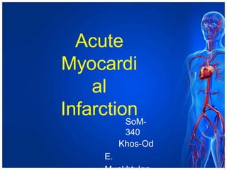 Acute
Myocardi
al
Infarction
SoM-
340
Khos-Od
E.
 