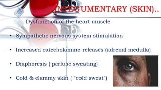 Myocardial infarction | PPTX