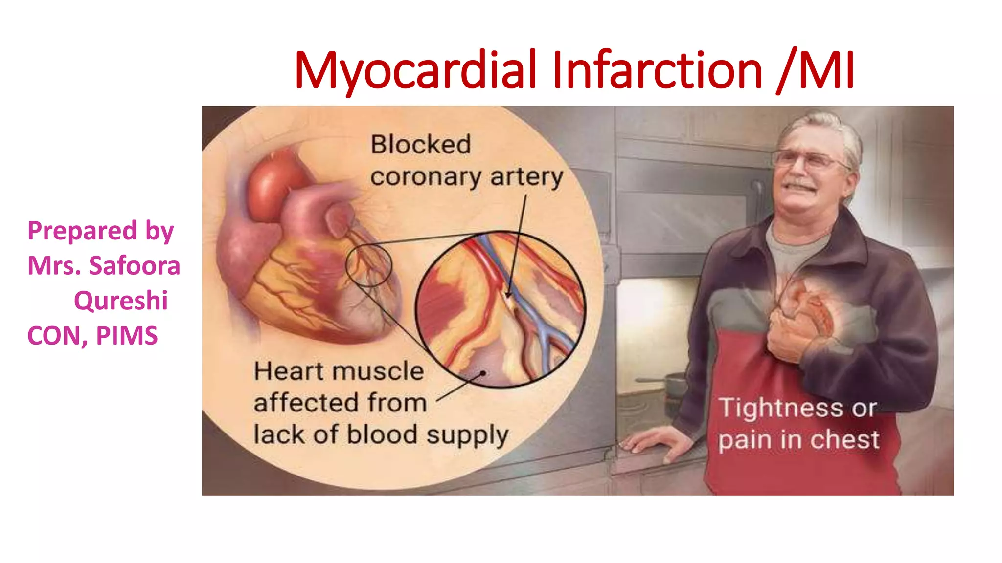 Myocardial Infarction MI [Autosaved].pptx