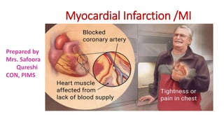 Myocardial Infarction /MI
Prepared by
Mrs. Safoora
Qureshi
CON, PIMS
 