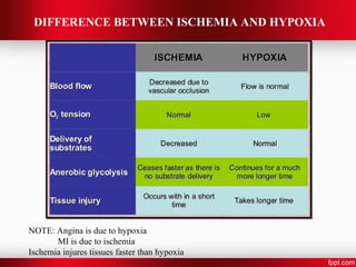Myocardial infarction with case | PPT