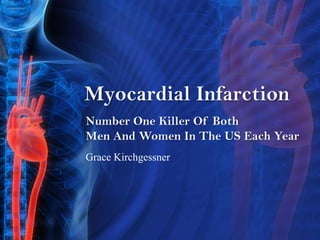 Number One Killer Of Both Men And Women In The US Each Year Myocardial Infarction  Grace Kirchgessner 