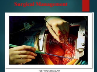 Surgical Management
 