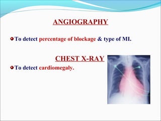 ANGIOGRAPHY
To detect percentage of blockage & type of MI.
CHEST X-RAY
To detect cardiomegaly.
 