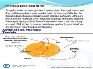 New oral anti-platelet drugs for AMI
Ticagrelor, unlike the thienopyridines Clopidogrel and Prasugrel, is not a pro-
drug and therefore has a faster onset of action with less variability than the
thienopyridines. It causes stronger platelet inhibition, particularly in the early
phase, and it is reversible, which maybe an advantage in reducing bleeding.
The ticagrelor group suffered fewer cardiovascular events, with the primary
end point of MI, stroke, or vascular death being significantly reduced without
any increase in major bleeding complications.
 