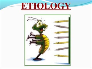 ETIOLOGY
 
