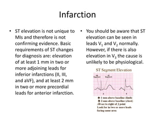 acute coronary syndrome (infarction and ischemia) | PPT