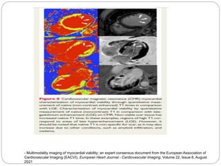 - Multimodality imaging of myocardial viability: an expert consensus document from the European Association of
Cardiovascular Imaging (EACVI), European Heart Journal - Cardiovascular Imaging, Volume 22, Issue 8, August
2021
 