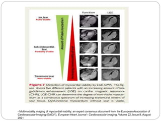 - Multimodality imaging of myocardial viability: an expert consensus document from the European Association of
Cardiovascular Imaging (EACVI), European Heart Journal - Cardiovascular Imaging, Volume 22, Issue 8, August
2021
 