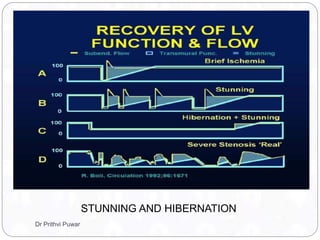STUNNING AND HIBERNATION
Dr Prithvi Puwar
 