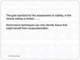 The gold standard for the assessment of viability, in the
clinical setting is limited…….
Noninvasive techniques can only identify tissue that
might benefit from revascularization.
Dr Prithvi Puwar
 