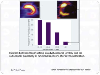 Relation between tracer uptake in a dysfunctional territory and the
subsequent probability of functional recovery after revascularization.
Taken from textbook of Braunwald 10th editionDr Prithvi Puwar
 
