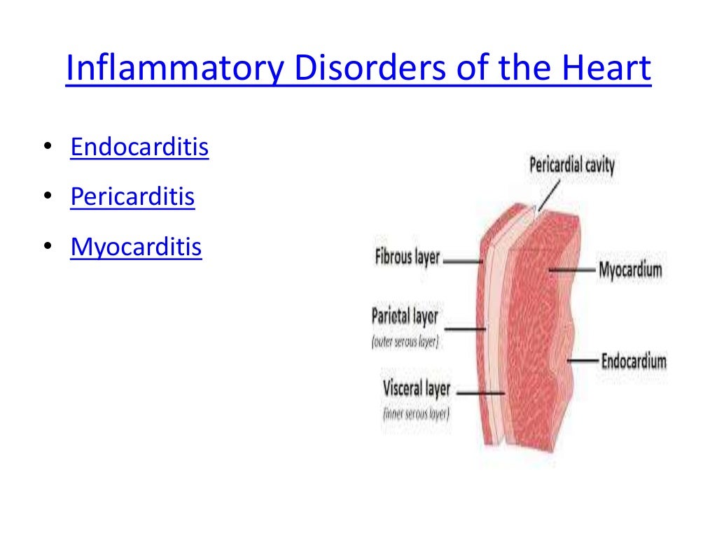 Myocarditis