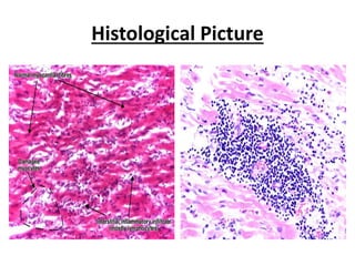 Histological Picture
 
