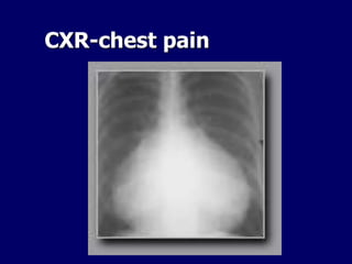 CXR-chest pain
 