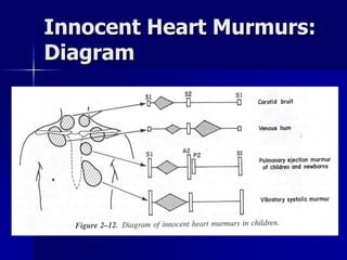 Innocent Heart Murmurs:
Diagram
 