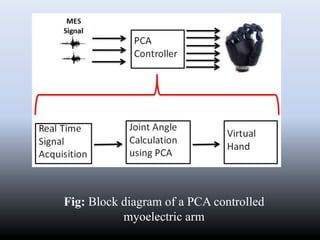 Fig: Block diagram of a PCA controlled
myoelectric arm
 