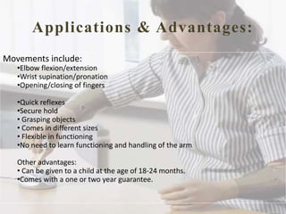 Applications & Advantages:
Movements include:
•Elbow flexion/extension
•Wrist supination/pronation
•Opening/closing of fingers
•Quick reflexes
•Secure hold
• Grasping objects
• Comes in different sizes
• Flexible in functioning
•No need to learn functioning and handling of the arm
Other advantages:
• Can be given to a child at the age of 18-24 months.
•Comes with a one or two year guarantee.
 