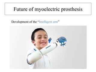 Future of myoelectric prosthesis
Development of the “Intelligent arm”
 