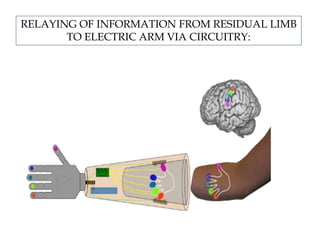 RELAYING OF INFORMATION FROM RESIDUAL LIMB
TO ELECTRIC ARM VIA CIRCUITRY:
 
